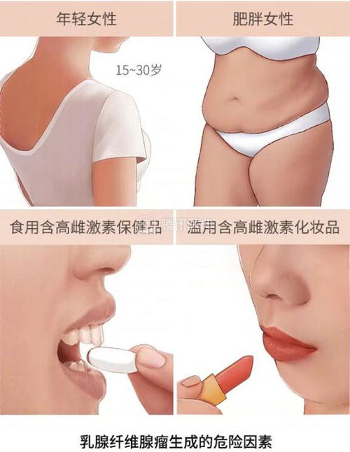 长在乳房里的这种瘤,对身体伤害并不大,一个办法就能去除