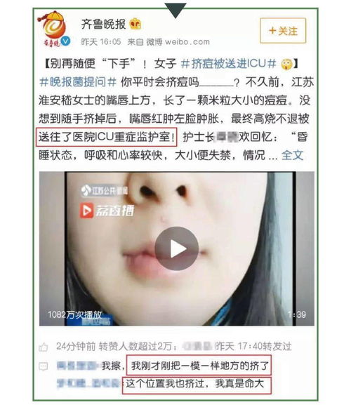 长痘痘的女生vs不长痘痘的女生,差距到底有多大