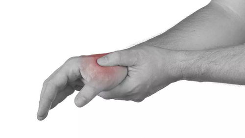 科普 大拇指腱鞘炎到底是什么 可以治疗吗