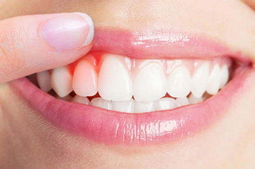 牙髓坏死的临床表现为,这些症状可能预示