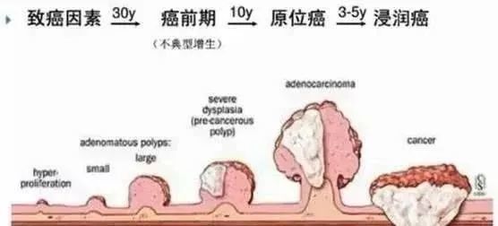 误把肠癌便血当痔疮,医生提醒 通过5点来分辨,早诊断早安心