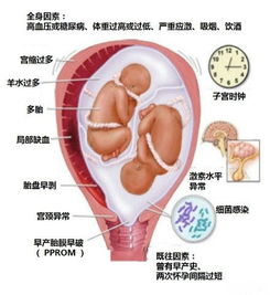 临床执业医师考试 妇产科 一张图记住早产危险因素 