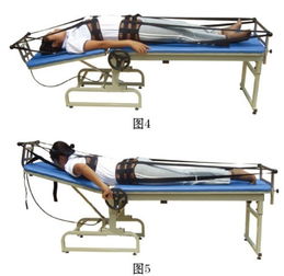 腰椎牵引方法,腰椎间盘突出症牵引疗法-第3张图片