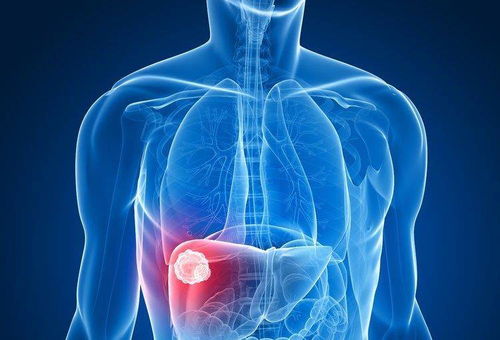 为什么体检时肝功能正常,结果却显示肝癌