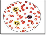 白细胞偏低3.45，淋巴细胞41.1偏高，中性粒细胞略低1.76，血红蛋白165略高，请问是什么原因，需要怎么注意