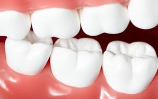 牙齿松动了是什么原因 牙齿松动了怎么办