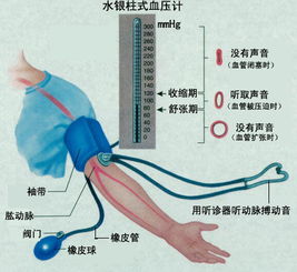 水银柱血压计测量高压时是以第一下跳动为准？还是以第一个微弱的声音为准？