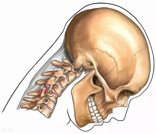 为何你的颈椎病总反反复复 专家告诉你真相