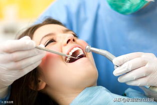 什么是牙齿根管治疗 牙医 这些情况需做根管治疗 