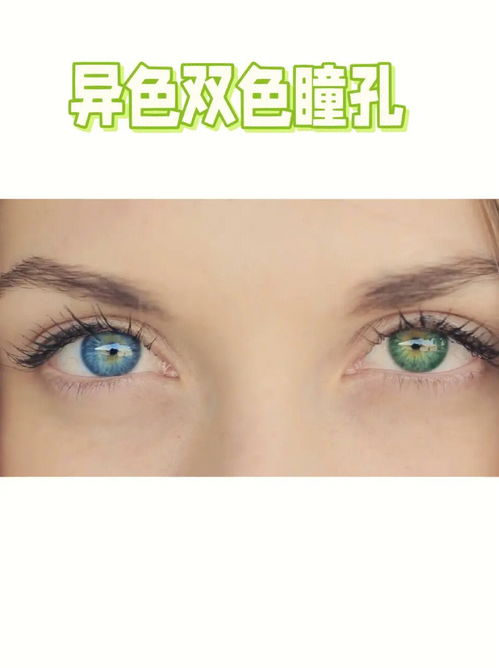 世上最强罕见的10种眼睛颜色,你选哪一种 