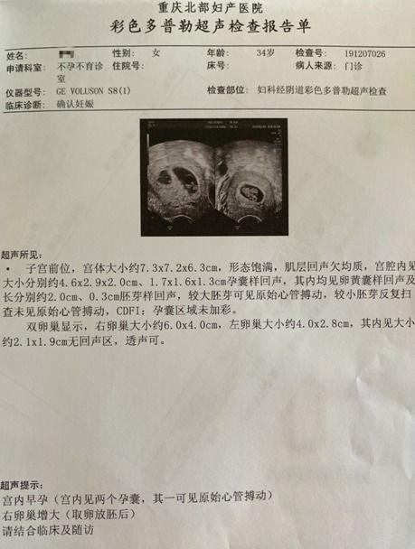 广州私人试管婴儿排名前十,广州试管婴儿排名前十：专业服务助力家庭圆梦  第9张