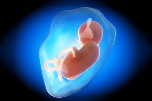原创怀孕时，孕妈尿液出现2个“情况”，或许是“羊水不足”的信号