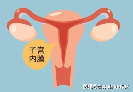 子宫内膜，息肉，不，动手术，可以，吗(子宫内膜息肉不手术可以治疗吗)