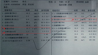 白球比偏低（1.24）意味着什么啊 不会是肝硬化吧？？？？