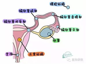 我的值是不是很低 像宫外吗