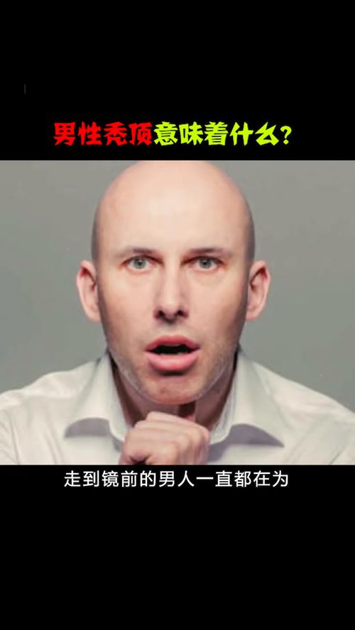 冷知识科普男生秃顶(男生秃顶了)(男生秃顶的征兆)