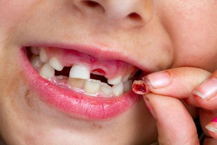 儿童磨牙流口水是什么原因引起的怎么治疗（宝宝磨牙流口水是怎么回事）