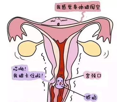 上饶江洲医院妇科分享 人流和药流的区别有哪些