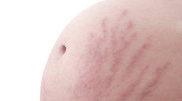 孕期肚皮有点痒是什么原因导致的