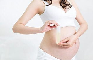 孕期护理(孕期护理怎么做呢)