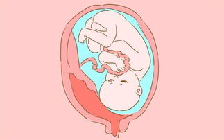 原创孕期遇到这四种情况，孕妈注定没法顺产，能避开的都有福气