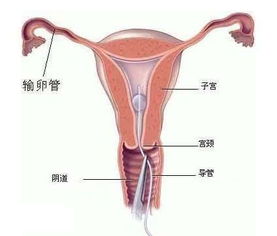 子宫囊肿严重吗有什么危害（子宫囊肿带给女性的伤害有多大）-图4