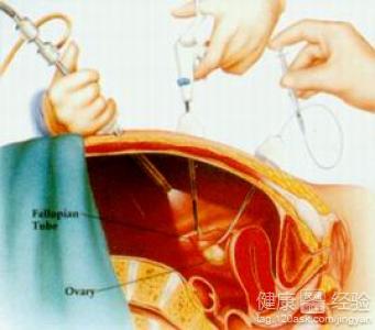 胆结石病人的胆壁厚0.4cm做腹腔镜手术合适吗