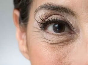 CMC皮肤管理 不容忽视的眼周除皱,就这么做
