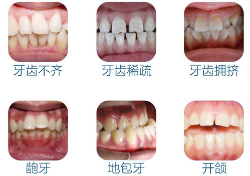 运用代币强化矫正幼儿的行为 运用代币强化矫正幼儿的行为 币圈生态