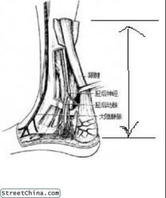 跟腱长度怎么量,轻松掌握！跟腱长度测量