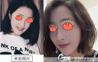 伊婉v和艾莉薇哪个好(伊婉艾莉薇哪个更好)