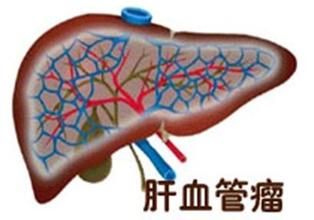 肝血管瘤手术切除有危险吗