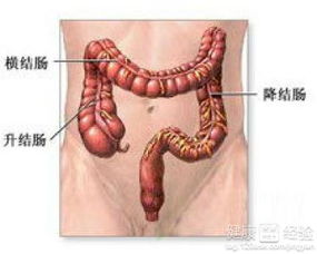 肠粘连性肠梗阻怎样治疗