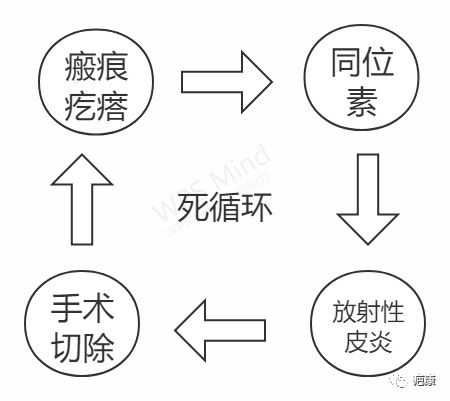 为什么十个医生有九个都不建议用同位素治疗瘢痕疙瘩 