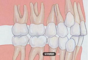 孩子爱吐舌导致牙齿不齐 牙齿不齐怎么办