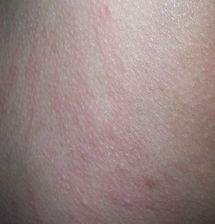 皮肤瘙痒是什么原因呢 