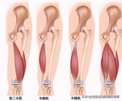 脆弱的腘绳肌 为啥受伤的总是我