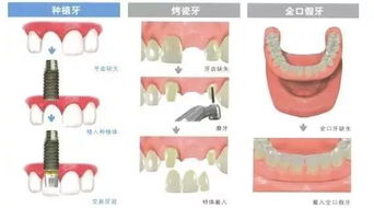 牙齿怎么种 是种下一颗种子,浇水施肥吗 