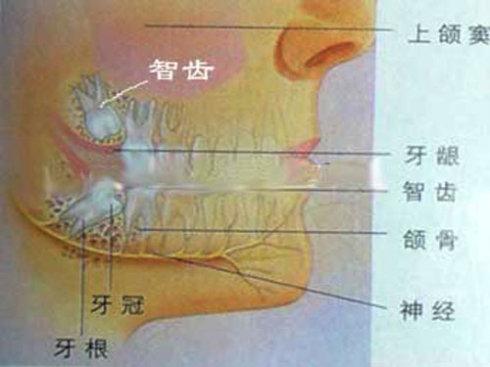 拔智齿可以报销医保吗 女性拔智齿注意事项 