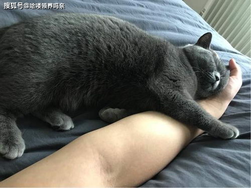 喜欢猫咪但猫毛过敏,还能养猫吗 从根源介绍起猫毛过敏该怎么办