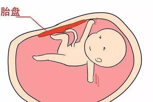 你们生孩子的时候，医生有没有问你胎盘要不要