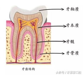 牙齿背面黑黑的东西到底是什么 