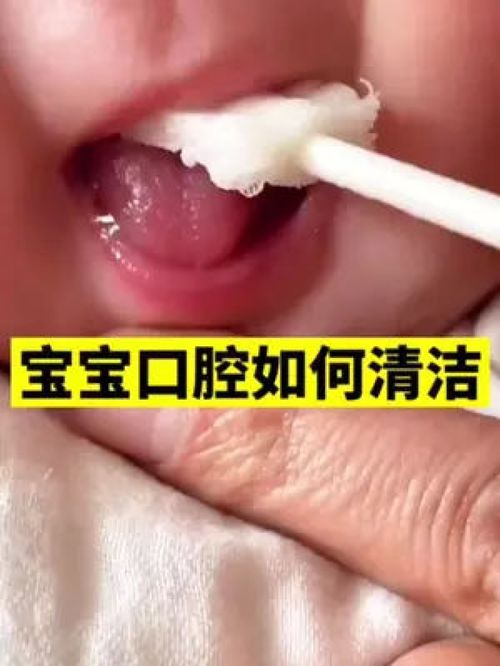小宝宝也需要做口腔清洁哦,长时间不清洁,堆积在舌苔容易有口腔问题,清洁棉棒快安排上吧 婴儿口腔清洁刷 宝宝 