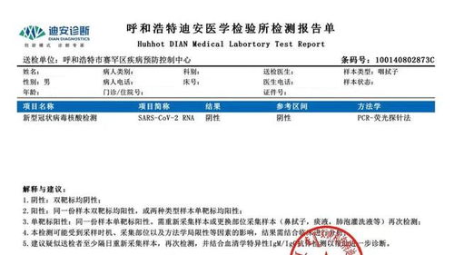 2021机场体温超过多少不让登机,带上一个证明,可保顺利出行