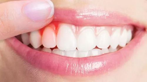 大连齿医生口腔 吃东西时经常出现牙齿酸软 疼痛无力