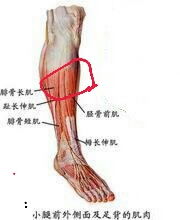 小腿骨头痛是怎么回事 大概是图片上红圈部位的骨头 每次打篮球 弹 