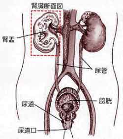 泌尿生殖道感染？尿路感染一般是什么原因造成的