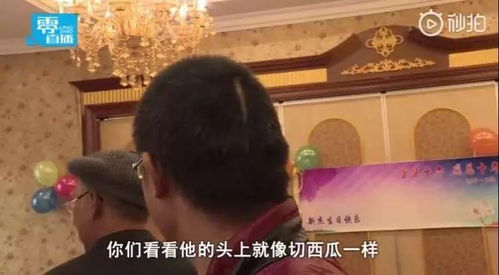 做了电休克之后为什么智商会下降(做了电休克之后为什么智商会下降很多)