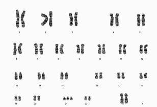 染色体怎么检查(染色体如何检查)