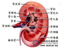 肾结石会影响生育吗 肾结石 胆结石 保胆保肾取石 亚洲专业治疗结石病的医院 